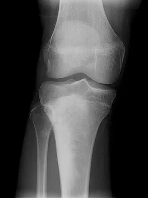 General Orthopedics 2026 Practice Questions: Set 5 (Solved) - Figure 50