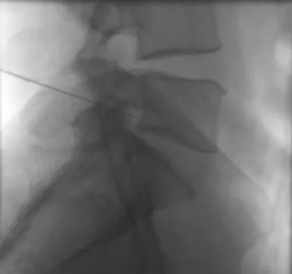 General Orthopedics 2026 Practice Questions: Set 5 (Solved) - Figure 55