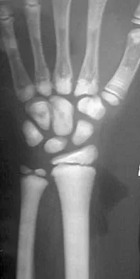 General Orthopedics 2026 Practice Questions: Set 5 (Solved) - Figure 58