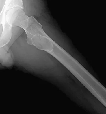 General Orthopedics 2026 Practice Questions: Set 5 (Solved) - Figure 61