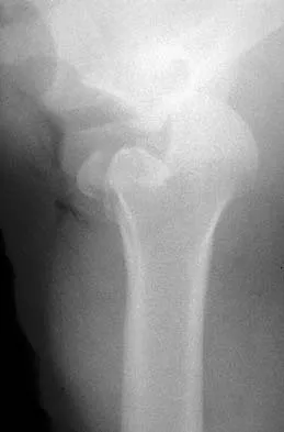 Click to enlarge General Orthopedics 2026 Practice Questions: Set 5 (Solved) - Figure 63