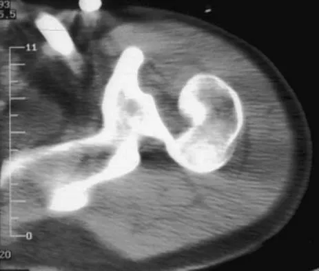 Click to enlarge General Orthopedics 2026 Practice Questions: Set 5 (Solved) - Figure 64