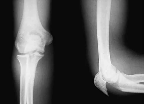 General Orthopedics 2026 Practice Questions: Set 5 (Solved) - Figure 7