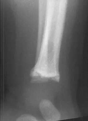 General Orthopedics 2026 Practice Questions: Set 5 (Solved) - Figure 72