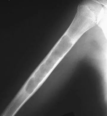 General Orthopedics 2026 Practice Questions: Set 5 (Solved) - Figure 73