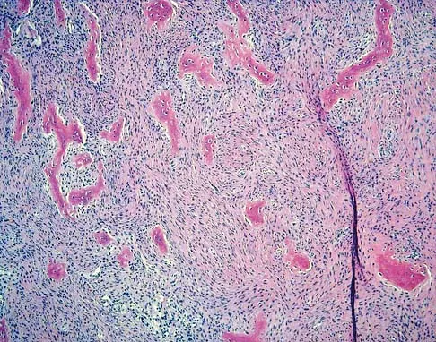 General Orthopedics 2026 Practice Questions: Set 5 (Solved) - Figure 75