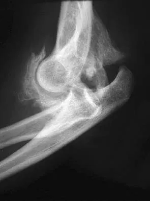 Orthopedic Board Review MCQs (2026 Edition) - Part 9