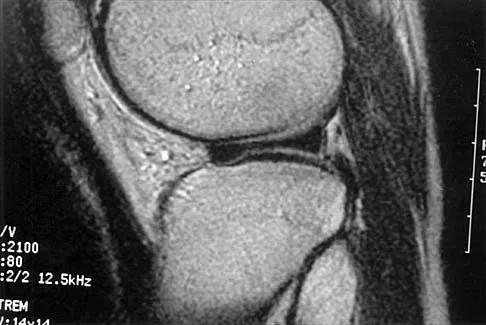 General Orthopedics 2026 Practice Questions: Set 5 (Solved) - Figure 79