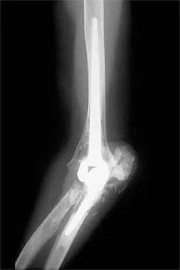General Orthopedics 2026 Practice Questions: Set 5 (Solved) - Figure 88