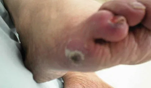 General Orthopedics 2026 Practice Questions: Set 5 (Solved) - Figure 91