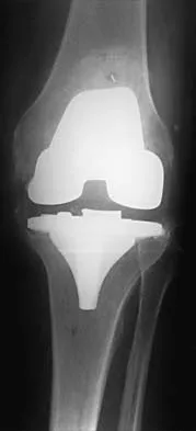 General Orthopedics 2026 Practice Questions: Set 5 (Solved) - Figure 97