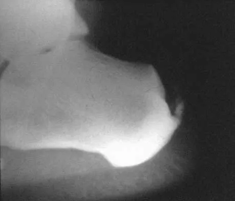 General Orthopedics Board Review 2026: High-Yield MCQs (Set 6) - Figure 1