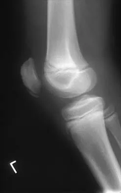 General Orthopedics Board Review 2026: High-Yield MCQs (Set 6) - Figure 102