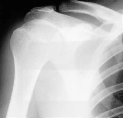 General Orthopedics Board Review 2026: High-Yield MCQs (Set 6) - Figure 105