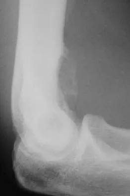 General Orthopedics Board Review 2026: High-Yield MCQs (Set 6) - Figure 107