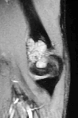 General Orthopedics Board Review 2026: High-Yield MCQs (Set 6) - Figure 108