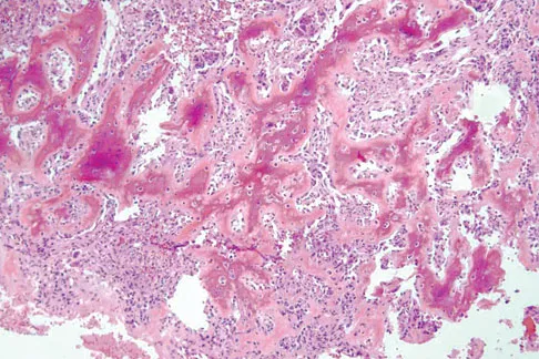 General Orthopedics Board Review 2026: High-Yield MCQs (Set 6) - Figure 110