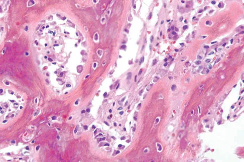 General Orthopedics Board Review 2026: High-Yield MCQs (Set 6) - Figure 111