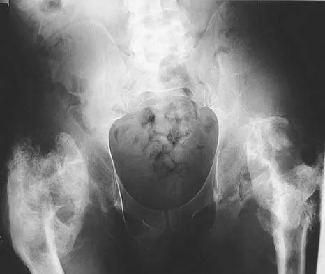 General Orthopedics Board Review 2026: High-Yield MCQs (Set 6) - Figure 112