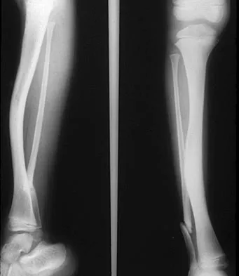 General Orthopedics Board Review 2026: High-Yield MCQs (Set 6) - Figure 119