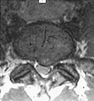 General Orthopedics Board Review 2026: High-Yield MCQs (Set 6) - Figure 121
