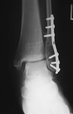 General Orthopedics Board Review 2026: High-Yield MCQs (Set 6) - Figure 126