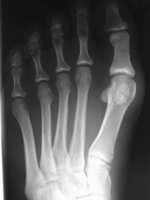 General Orthopedics Board Review 2026: High-Yield MCQs (Set 6) - Figure 14