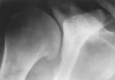 AAOS Orthopedic MCQs (Set 1): Pediatric Elbow & Forearm Trauma | 2026 Board Review