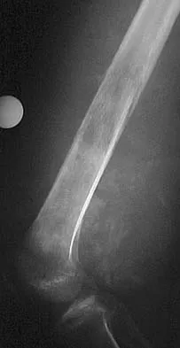 General Orthopedics Board Review 2026: High-Yield MCQs (Set 6) - Figure 30