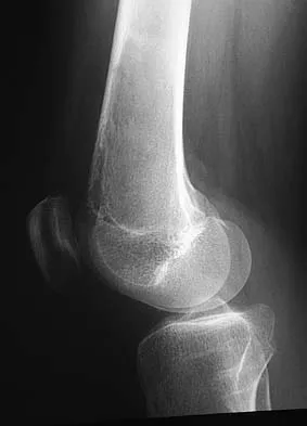 General Orthopedics Board Review 2026: High-Yield MCQs (Set 6) - Figure 33