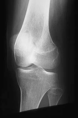 General Orthopedics Board Review 2026: High-Yield MCQs (Set 6) - Figure 34