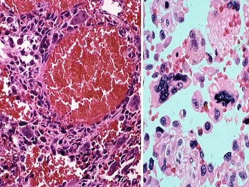 General Orthopedics Board Review 2026: High-Yield MCQs (Set 6) - Figure 42