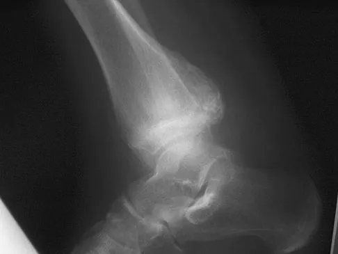 General Orthopedics Board Review 2026: High-Yield MCQs (Set 6) - Figure 43