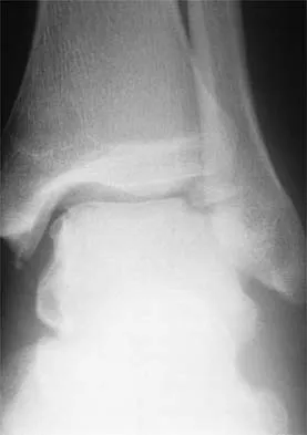 General Orthopedics Board Review 2026: High-Yield MCQs (Set 6) - Figure 46