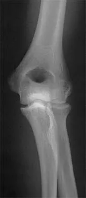 General Orthopedics Board Review 2026: High-Yield MCQs (Set 6) - Figure 48