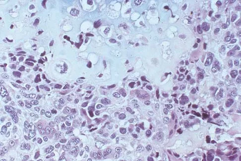 General Orthopedics Board Review 2026: High-Yield MCQs (Set 6) - Figure 5