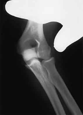 General Orthopedics Board Review 2026: High-Yield MCQs (Set 6) - Figure 50