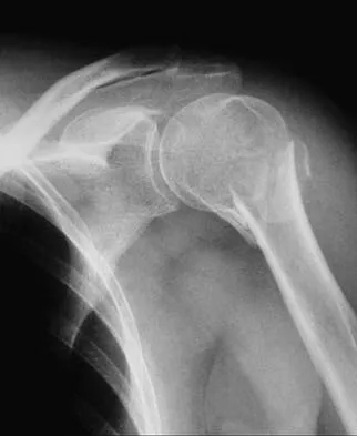 General Orthopedics Board Review 2026: High-Yield MCQs (Set 6) - Figure 6