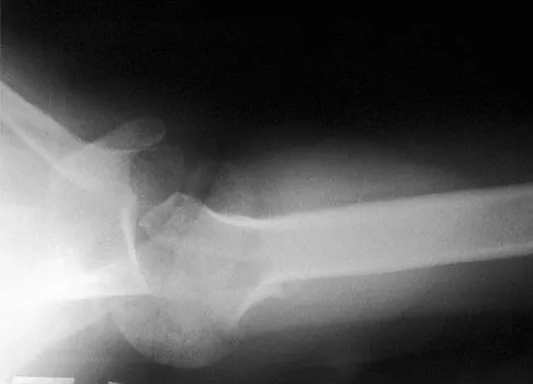 General Orthopedics Board Review 2026: High-Yield MCQs (Set 6) - Figure 60