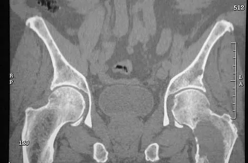 General Orthopedics Board Review 2026: High-Yield MCQs (Set 6) - Figure 62
