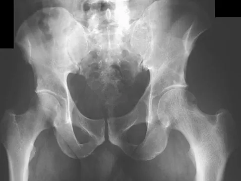 General Orthopedics Board Review 2026: High-Yield MCQs (Set 6) - Figure 64