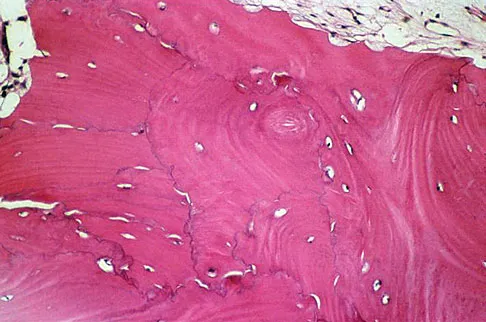 General Orthopedics Board Review 2026: High-Yield MCQs (Set 6) - Figure 68