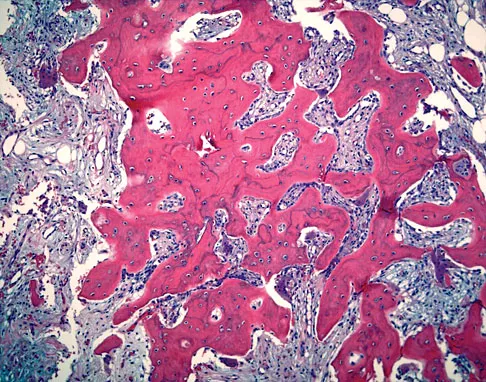 General Orthopedics Board Review 2026: High-Yield MCQs (Set 6) - Figure 69