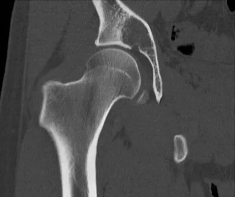 General Orthopedics Board Review 2026: High-Yield MCQs (Set 6) - Figure 71