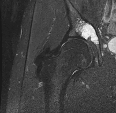 General Orthopedics Board Review 2026: High-Yield MCQs (Set 6) - Figure 73