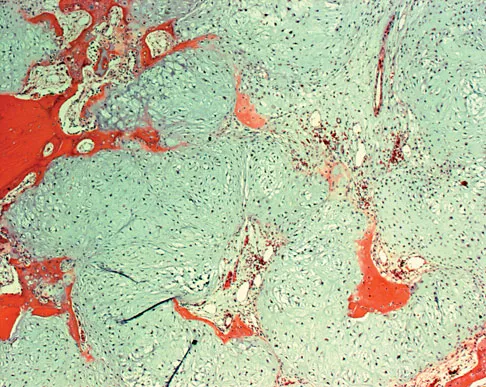 General Orthopedics Board Review 2026: High-Yield MCQs (Set 6) - Figure 74