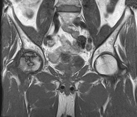 General Orthopedics Board Review 2026: High-Yield MCQs (Set 6) - Figure 84