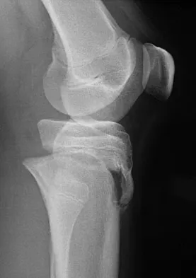 General Orthopedics Board Review 2026: High-Yield MCQs (Set 6) - Figure 89