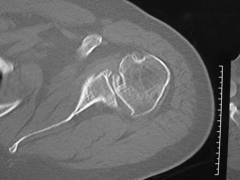 General Orthopedics Board Review 2026: High-Yield MCQs (Set 6) - Figure 9