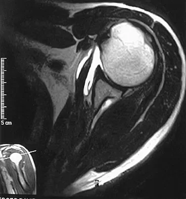 General Orthopedics Board Review 2026: High-Yield MCQs (Set 6) - Figure 99